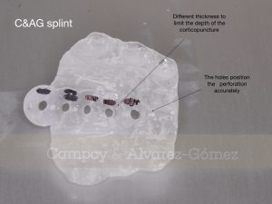 C&AG splint, corticopuncture, MARPE, Power expander, ortodoncia murcia